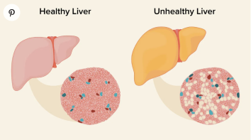 Know your liver