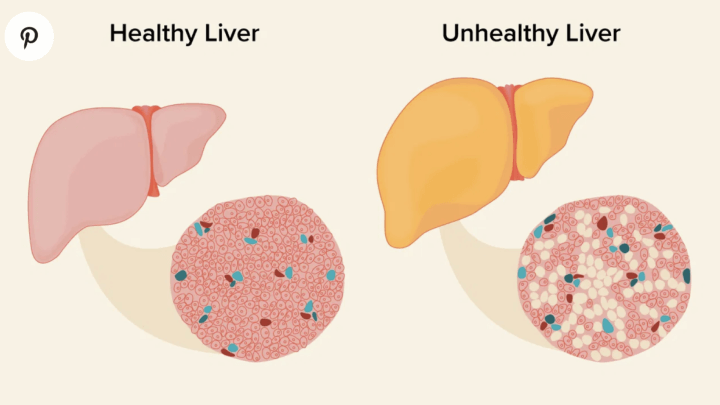 Know your liver